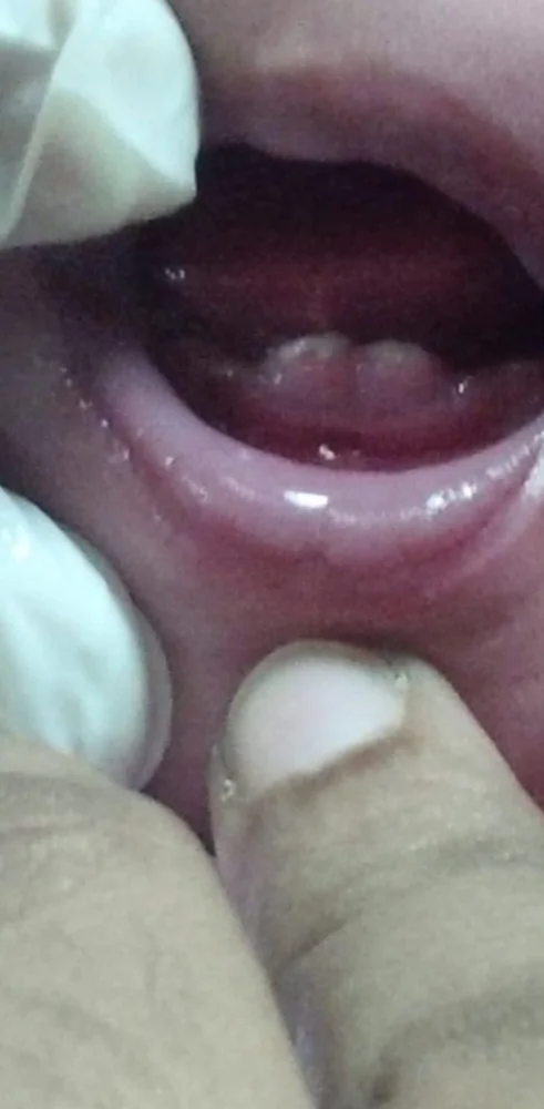 Examining an infant's mouth, showing the first lower front teeth