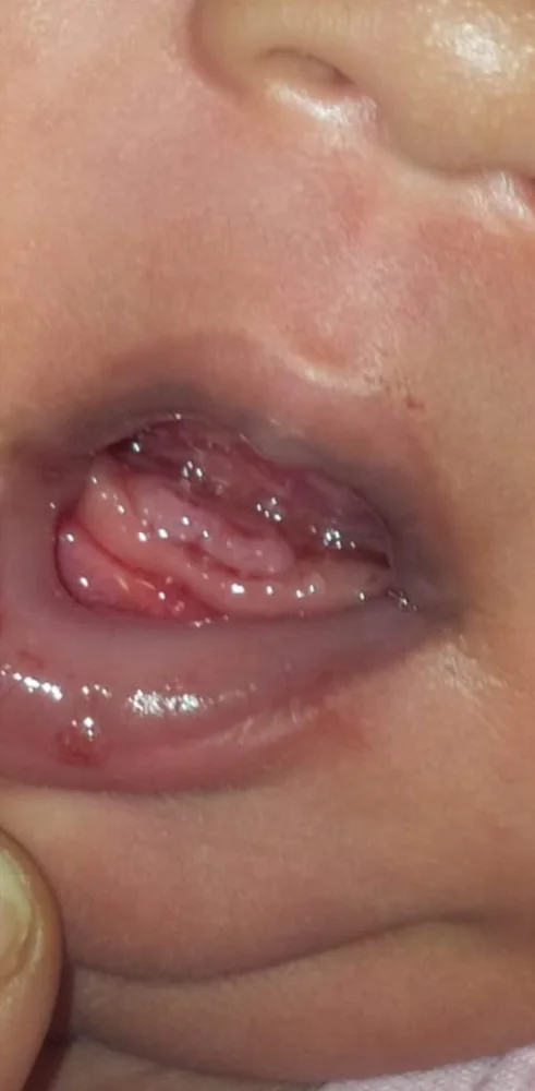 A close view of an infant's lower lip and gums