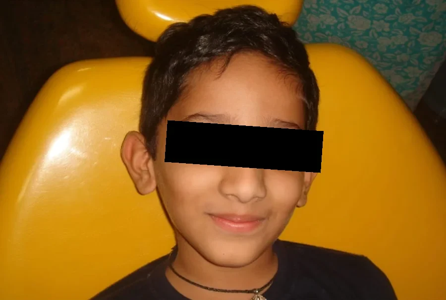 A boy smiling in the dental chair