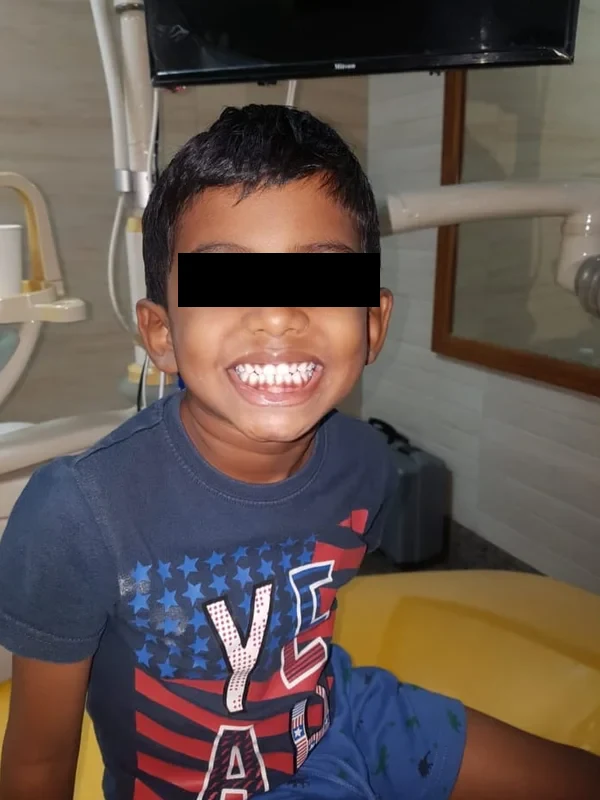 A young boy smiling in the dental clinic
