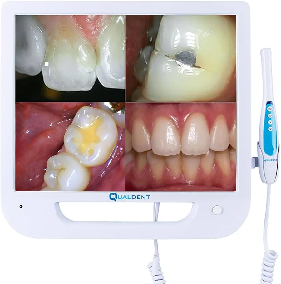 Intraoral camera handpiece beside a monitor showing close-up images of teeth
