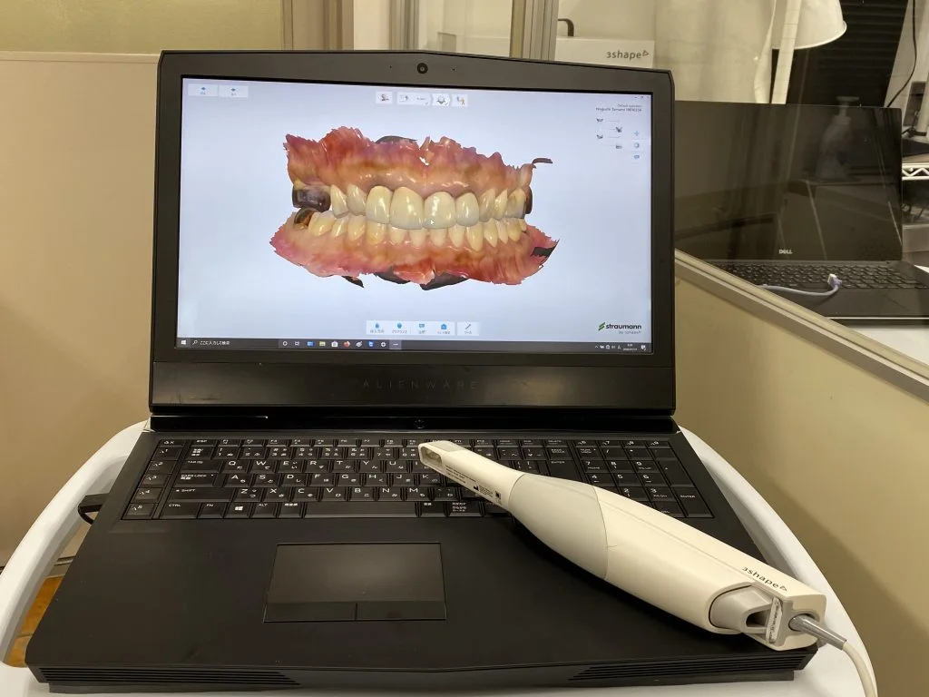 Intraoral scanner wand resting on a laptop showing a 3D scan of a patient's teeth